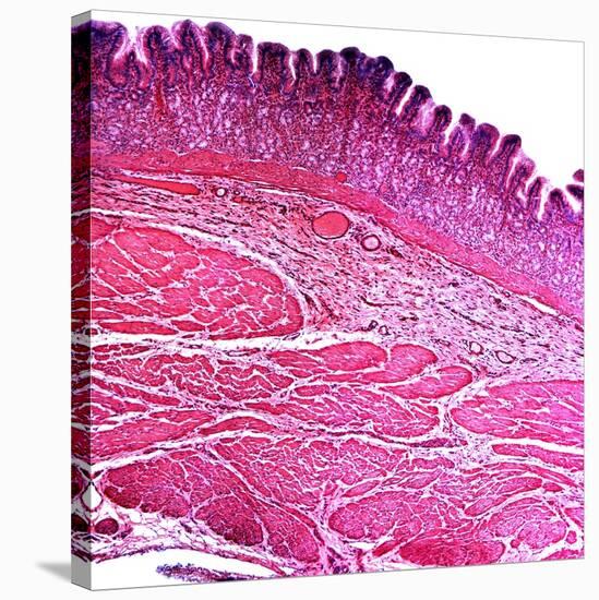 Small Intestine Section, Light Micrograph-Dr. Keith Wheeler-Stretched Canvas