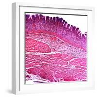 Small Intestine Section, Light Micrograph-Dr. Keith Wheeler-Framed Premium Photographic Print