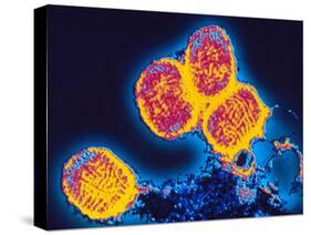 Smallpox Variola Viruses-PASIEKA-Stretched Canvas