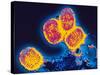 Smallpox Variola Viruses-PASIEKA-Stretched Canvas