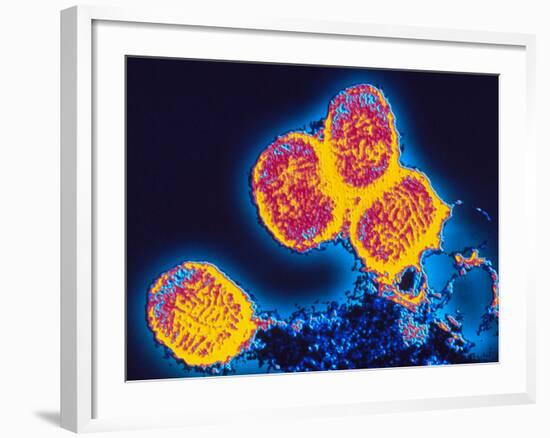 Smallpox Variola Viruses-PASIEKA-Framed Photographic Print