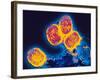 Smallpox Variola Viruses-PASIEKA-Framed Photographic Print