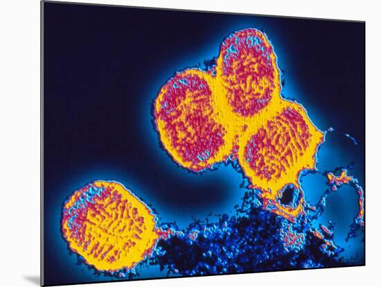 Smallpox Variola Viruses-PASIEKA-Mounted Photographic Print