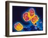 Smallpox Variola Viruses-PASIEKA-Framed Photographic Print