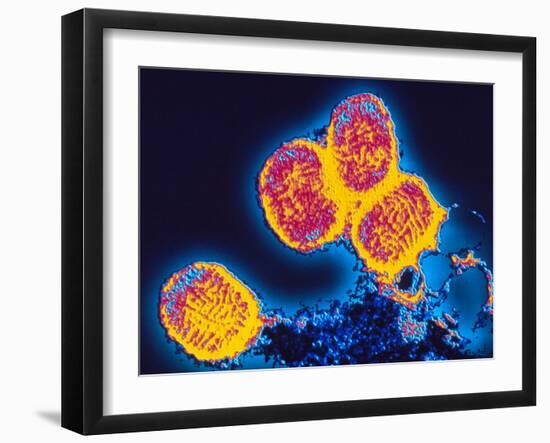 Smallpox Variola Viruses-PASIEKA-Framed Photographic Print