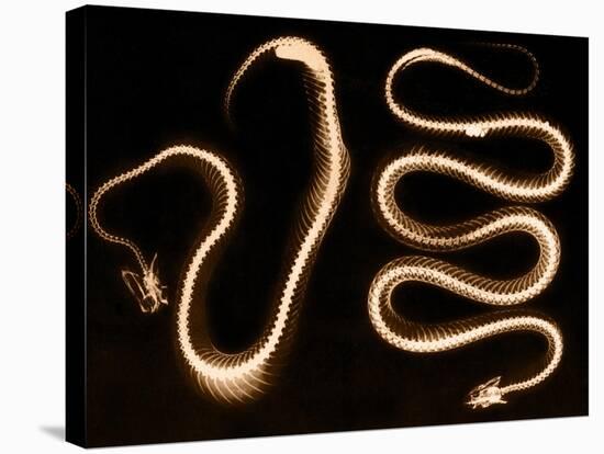 Snake Skeletons, X-ray-Science Source-Stretched Canvas