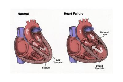 Anatomy of Heart Interior, Frontal Section