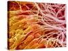 Sperm in Testis of a Rat-Micro Discovery-Stretched Canvas