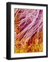 Sperm in Testis of a Rat-Micro Discovery-Framed Photographic Print