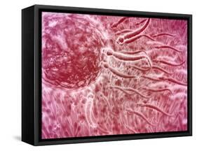 Sperm Traveling Towards Egg with Cellia-null-Framed Stretched Canvas