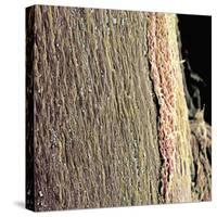 Spinal Cord, SEM-Steve Gschmeissner-Stretched Canvas