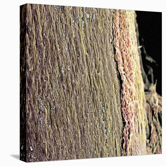 Spinal Cord, SEM-Steve Gschmeissner-Stretched Canvas