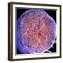 Spinal Nerve, SEM-Thomas Deerinck-Framed Premium Photographic Print