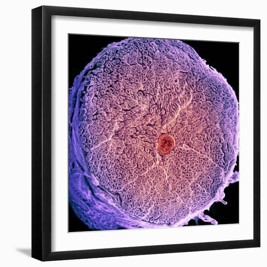 Spinal Nerve, SEM-Thomas Deerinck-Framed Premium Photographic Print