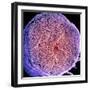 Spinal Nerve, SEM-Thomas Deerinck-Framed Premium Photographic Print