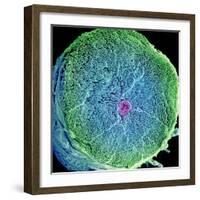 Spinal Nerve, SEM-Thomas Deerinck-Framed Premium Photographic Print