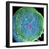 Spinal Nerve, SEM-Thomas Deerinck-Framed Premium Photographic Print