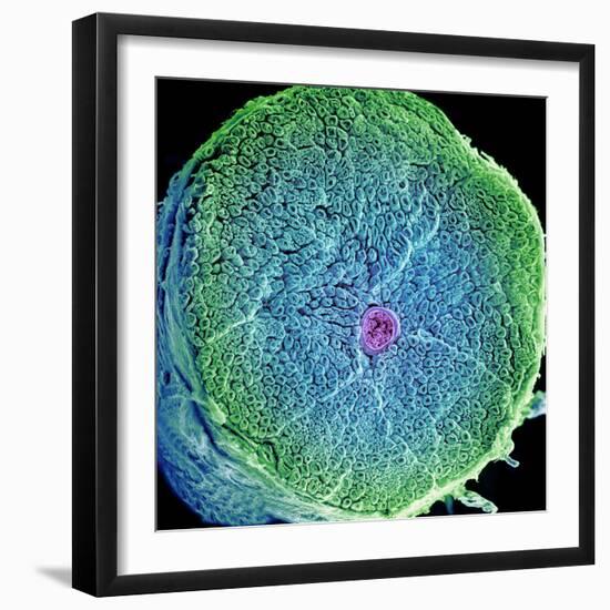 Spinal Nerve, SEM-Thomas Deerinck-Framed Premium Photographic Print