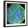 Spinal Nerve, SEM-Thomas Deerinck-Framed Premium Photographic Print