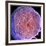 Spinal Nerve, SEM-Thomas Deerinck-Framed Photographic Print