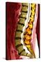 Spine Degeneration, MRI Scan-Du Cane Medical-Stretched Canvas