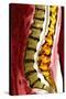 Spine Degeneration, MRI Scan-Du Cane Medical-Stretched Canvas