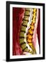 Spine Degeneration, MRI Scan-Du Cane Medical-Framed Photographic Print