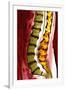 Spine Degeneration, MRI Scan-Du Cane Medical-Framed Photographic Print