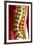 Spine Degeneration, MRI Scan-Du Cane Medical-Framed Photographic Print