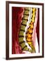 Spine Degeneration, MRI Scan-Du Cane Medical-Framed Photographic Print