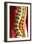 Spine Degeneration, MRI Scan-Du Cane Medical-Framed Photographic Print