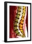 Spine Degeneration, MRI Scan-Du Cane Medical-Framed Photographic Print