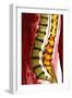 Spine Degeneration, MRI Scan-Du Cane Medical-Framed Photographic Print