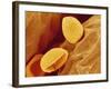 Spores of a Flowering Fern-Micro Discovery-Framed Photographic Print