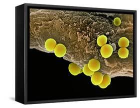 Staphylococcus Aureus Bacteria, SEM-Science Photo Library-Framed Stretched Canvas