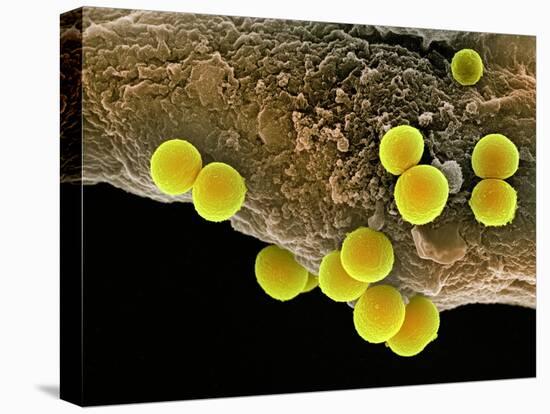 Staphylococcus Aureus Bacteria, SEM-Science Photo Library-Stretched Canvas