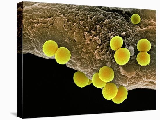 Staphylococcus Aureus Bacteria, SEM-Science Photo Library-Stretched Canvas