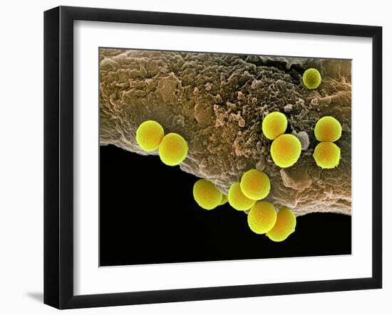 Staphylococcus Aureus Bacteria, SEM-Science Photo Library-Framed Photographic Print