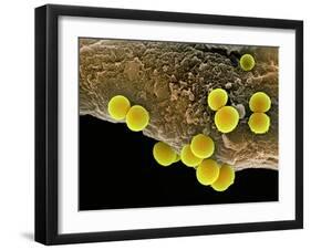 Staphylococcus Aureus Bacteria, SEM-Science Photo Library-Framed Photographic Print