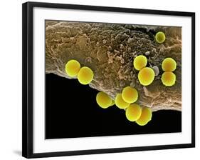 Staphylococcus Aureus Bacteria, SEM-Science Photo Library-Framed Photographic Print