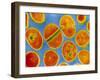 Staphylococcus Aureus Bacteria-null-Framed Photographic Print