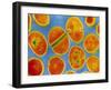 Staphylococcus Aureus Bacteria-null-Framed Photographic Print