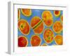 Staphylococcus Aureus Bacteria-null-Framed Photographic Print