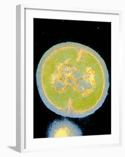 Staphylococcus Epidermidis Bacterium-null-Framed Photographic Print