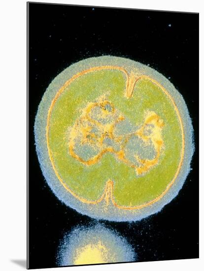 Staphylococcus Epidermidis Bacterium-null-Mounted Photographic Print