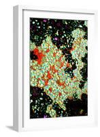 Starch Grains In Potato, Light Micrograph-Dr. Keith Wheeler-Framed Photographic Print