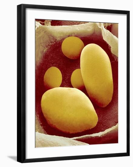 Starch Grains of Potato Cells-Micro Discovery-Framed Photographic Print