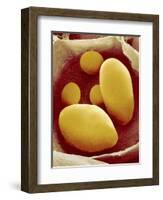 Starch Grains of Potato Cells-Micro Discovery-Framed Photographic Print