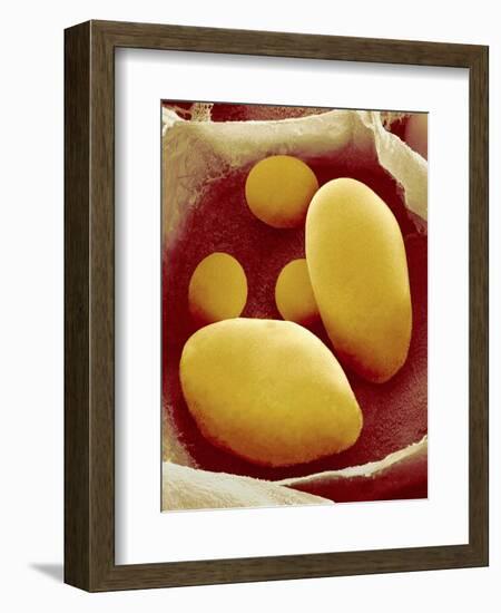 Starch Grains of Potato Cells-Micro Discovery-Framed Photographic Print