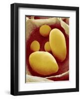 Starch Grains of Potato Cells-Micro Discovery-Framed Photographic Print